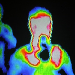 Thermal cameras have several benefits for surveillance