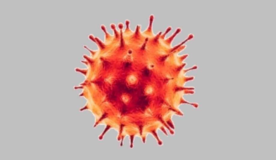 Securiton AG stresses on Business Continuity Management to secure health of staff, partners while delivering services during COVID19 crisis