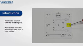 Vanderbilt seismic detector drill template guide